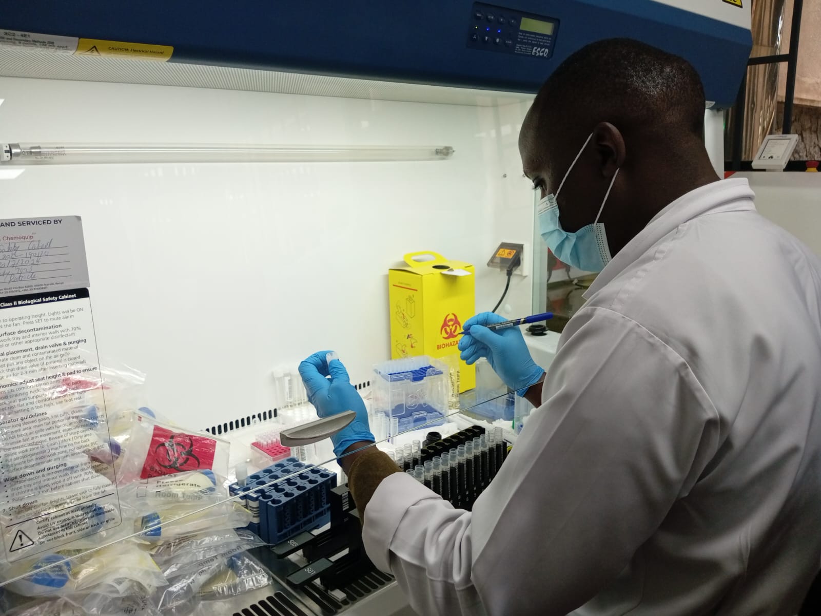 Revolutionising TB Diagnosis: High-tech machine delivers results in three hours